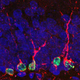 Image for article titled Memory-restoring compound could destroy Alzheimer's forever